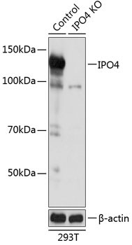 IPO4 Rabbit Polyclonal Antibody [KO Validated]
