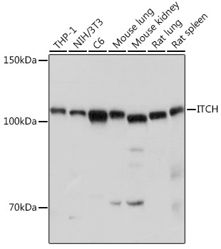 ITCH Rabbit Polyclonal Antibody [KO Validated]