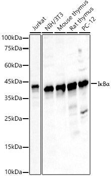 I?BAlpha Rabbit Polyclonal Antibody [KO Validated]