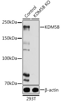 KDM5B Rabbit Polyclonal Antibody [KO Validated]