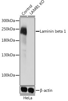 Laminin beta 1 Rabbit Polyclonal Antibody [KO Validated]