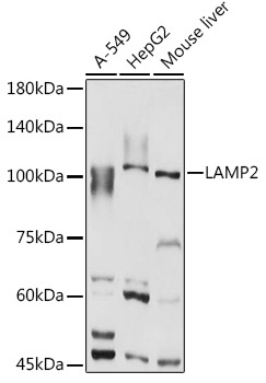 LAMP2 Rabbit Polyclonal Antibody [KO Validated]