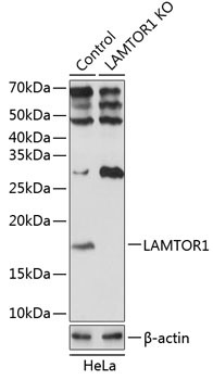 LAMTOR1 Rabbit Polyclonal Antibody [KO Validated]