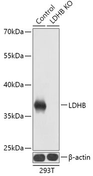 LDHB Rabbit Polyclonal Antibody [KO Validated]