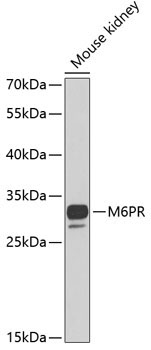 M6PR Rabbit Polyclonal Antibody [KO Validated]