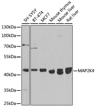 MAP2K4 Rabbit Polyclonal Antibody [KO Validated]
