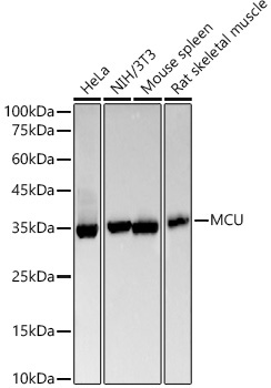 MCU Rabbit Monoclonal Antibody [KO Validated]