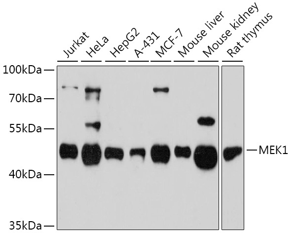 MEK1 Rabbit Polyclonal Antibody [KO Validated]