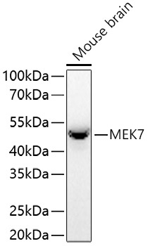 MEK7 Rabbit Monoclonal Antibody [KO Validated]