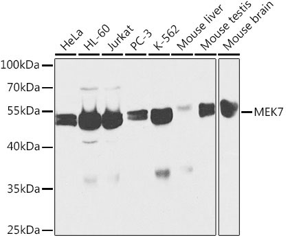 MEK7 Rabbit Polyclonal Antibody [KO Validated]