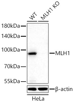 MLH1 Rabbit Monoclonal Antibody [KO Validated]
