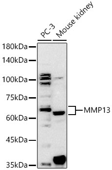 MMP13 Rabbit Polyclonal Antibody [KO Validated]