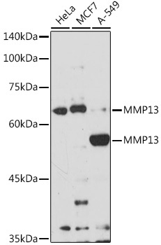 MMP13 Rabbit Polyclonal Antibody [KO Validated]