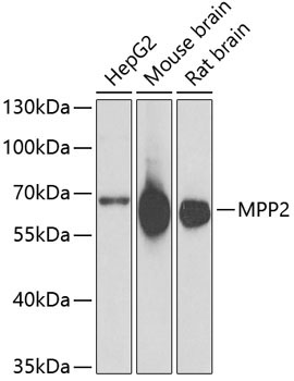 MPP2 Rabbit Polyclonal Antibody [KO Validated]