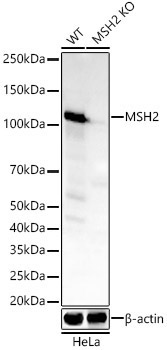 MSH2 Rabbit Monoclonal Antibody [KO Validated]