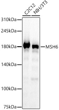 MSH6 Rabbit Monoclonal Antibody [KO Validated]