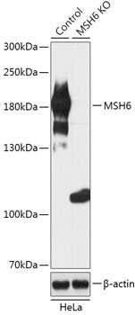 MSH6 Rabbit Polyclonal Antibody [KO Validated]