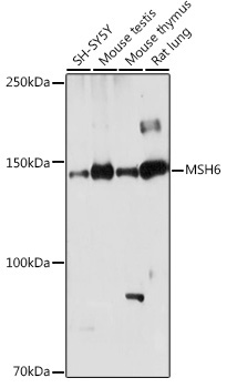 MSH6 Rabbit Polyclonal Antibody [KO Validated]