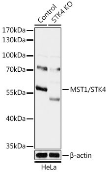 MST1/STK4 Rabbit Polyclonal Antibody [KO Validated]