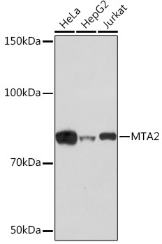 MTA2 Rabbit Monoclonal Antibody [KO Validated]