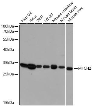 MTCH2 Rabbit Polyclonal Antibody [KO Validated]