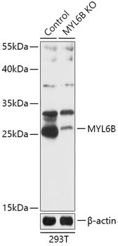 MYL6B Rabbit Polyclonal Antibody [KO Validated]