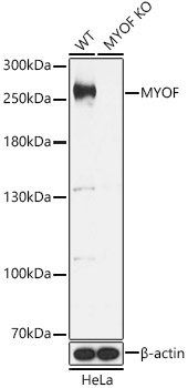 MYOF Rabbit Polyclonal Antibody [KO Validated]