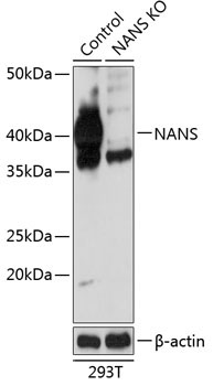 NANS Rabbit Polyclonal Antibody [KO Validated]