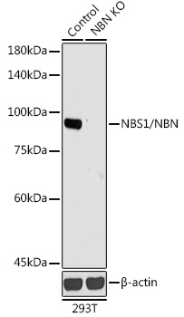 NBS1/NBN Rabbit Polyclonal Antibody [KO Validated]