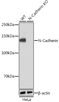 N-Cadherin Rabbit Monoclonal Antibody [KO Validated]