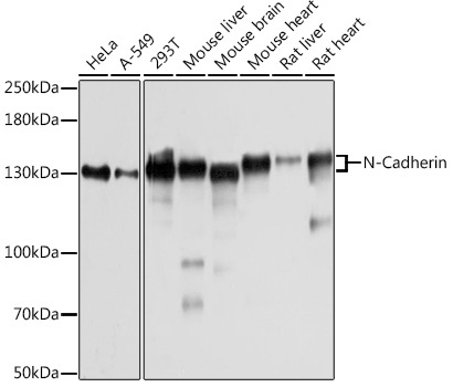 N-Cadherin Rabbit Polyclonal Antibody [KO Validated]