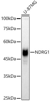 NDRG1 Rabbit Polyclonal Antibody [KO Validated]