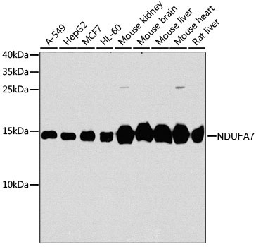 NDUFA7 Rabbit Polyclonal Antibody [KO Validated]