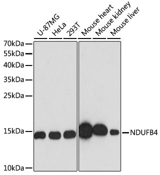 NDUFB4 Rabbit Polyclonal Antibody [KO Validated]