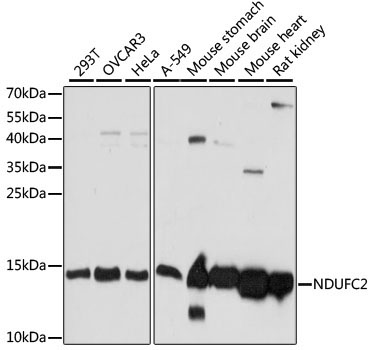 NDUFC2 Rabbit Polyclonal Antibody [KO Validated]