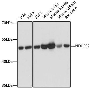 NDUFS2 Rabbit Polyclonal Antibody [KO Validated]