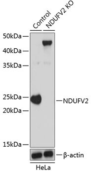 NDUFV2 Rabbit Polyclonal Antibody [KO Validated]