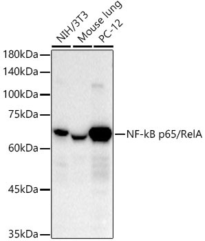 NF-kB p65/RelA Rabbit Monoclonal Antibody [KO Validated]