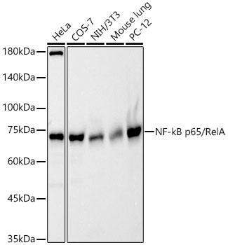 NF-kB p65/RelA Rabbit Polyclonal Antibody [KO Validated]