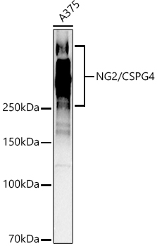NG2/CSPG4 Rabbit Polyclonal Antibody [KO Validated]