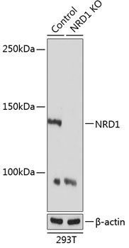 NRD1 Rabbit Polyclonal Antibody [KO Validated]