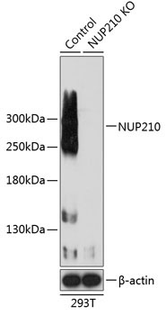 NUP210 Rabbit Polyclonal Antibody [KO Validated]