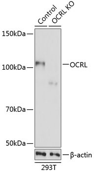 OCRL Rabbit Polyclonal Antibody [KO Validated]