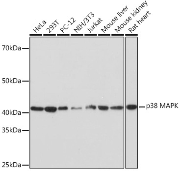p38 MAPK Rabbit Monoclonal Antibody [KO Validated]