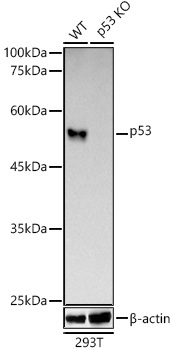 p53 Rabbit Monoclonal Antibody [KO Validated]