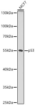 p53 Rabbit Polyclonal Antibody [KO Validated]