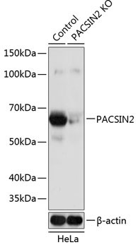 PACSIN2 Rabbit Polyclonal Antibody [KO Validated]