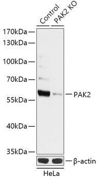 PAK2 Rabbit Polyclonal Antibody [KO Validated]