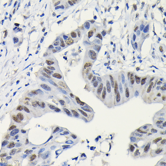PARP1 Rabbit Polyclonal Antibody [KO Validated]