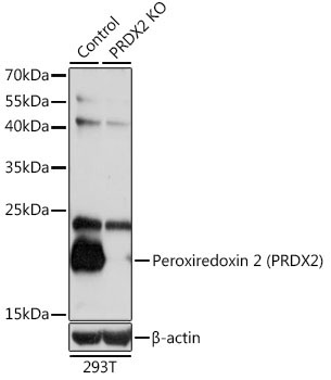 Peroxiredoxin 2 (PRDX2) Rabbit Polyclonal Antibody [KO Validated]